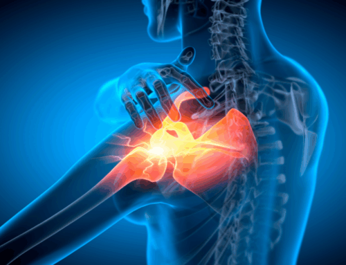 Niestabilność stawu ramiennego. Różnica między zwichnięciem a nawykową niestabilnością