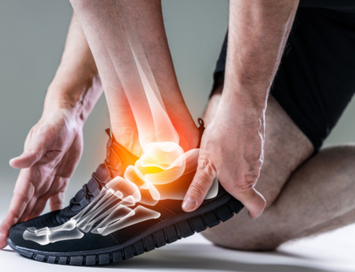 Skręcenie stawu skokowego – przyczyny, objawy i metody leczenia